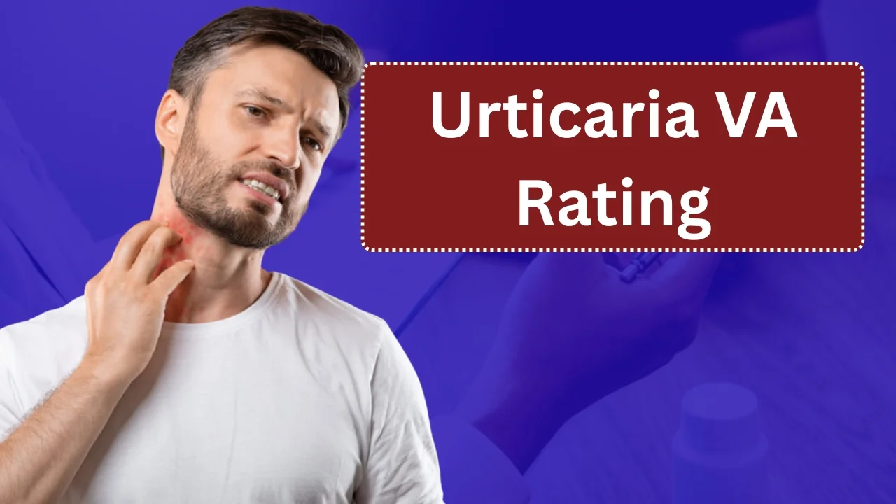 Urticaria VA Rating
